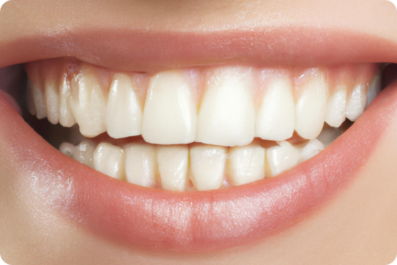 Что включает процедура