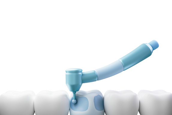 Что включает процедура