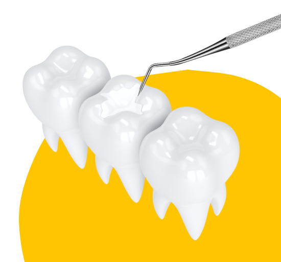 Лечение и пломбирование молочных зубов 