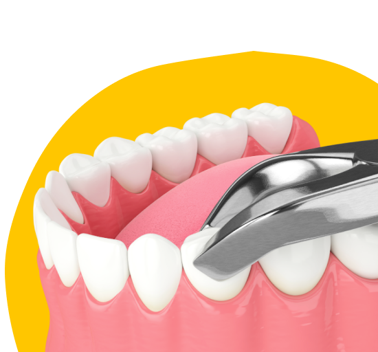 Удаление Молочных Зубов в «Atmosfera» 