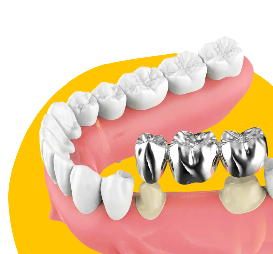 Установка Коронок на Молочные Зубы