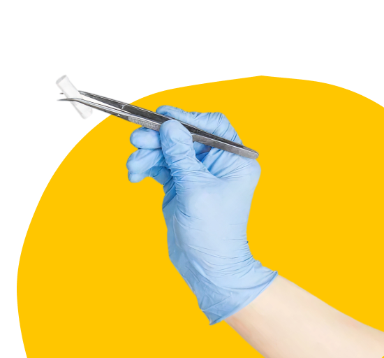 Френулопластика в Кишинёве