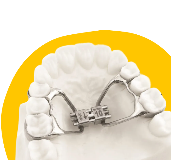 Небный расширитель