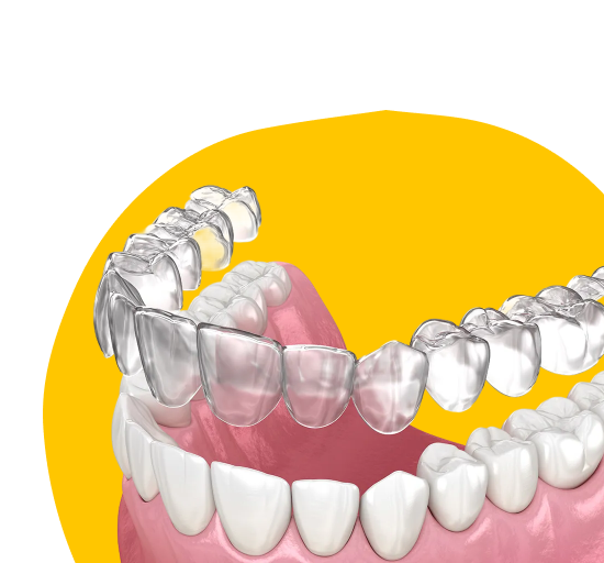 Выравнивание системой Ordoline