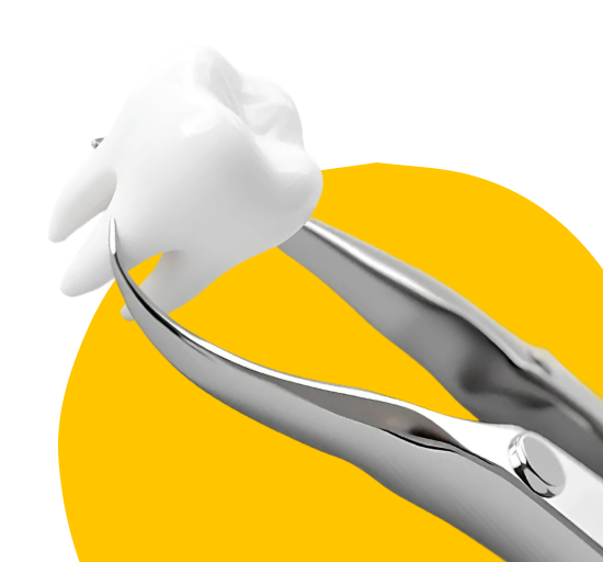 Удаление зуба