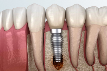 Запишитесь на прием, если:
