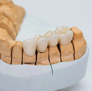 Когда стоит устанавливать мост