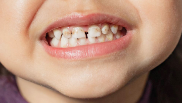 Когда стоит записаться на консультацию?