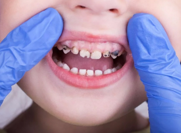 Когда необходимо идти к стоматологу? 