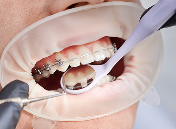 Когда вам нужен именно ортодонт