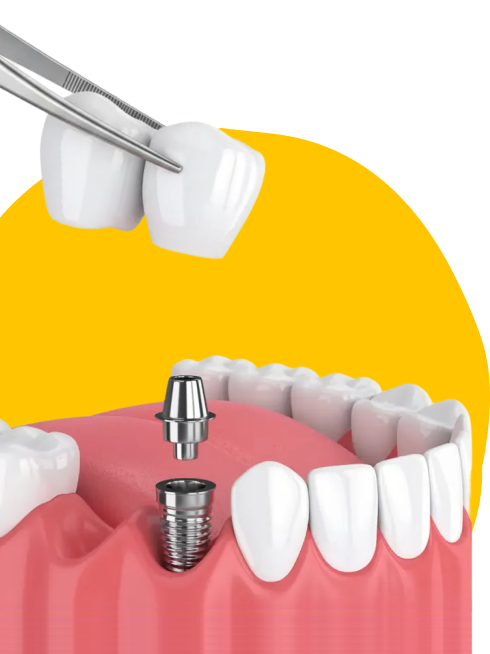 Как проходит процедура: