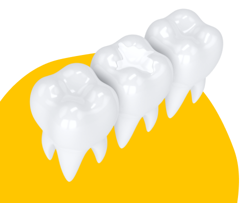 Лечение кариеса в «Atmosfera» подойдет вам, если: