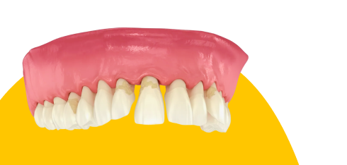 Когда рекомендуется идти к врачу: