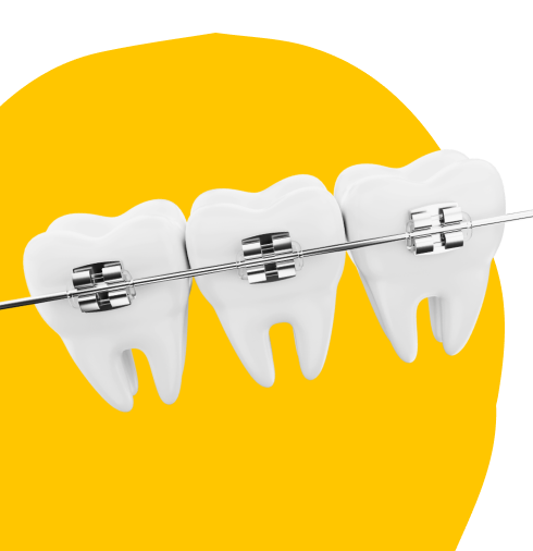 Есть отличия в системе ? 