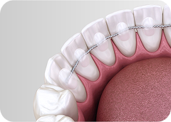 Опасение, что результат не удержится?