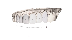  Визуализация улыбки