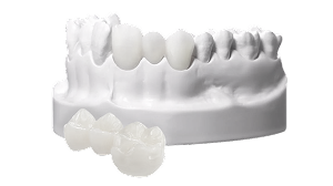  Изготовление протеза 