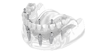  Финальная фиксация